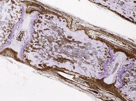 Mesencymal cells Immunohistochemistry