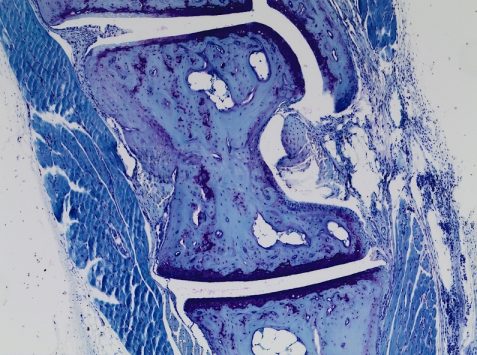 Metatarsal cartilage Toluidine blue staining